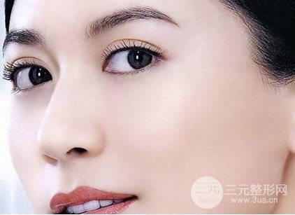 微創(chuàng)雙眼皮手術多久恢復