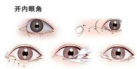 為什么要優(yōu)先考慮開眼角?
