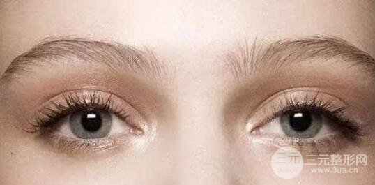 有必要同時做雙眼皮和開眼角嗎?