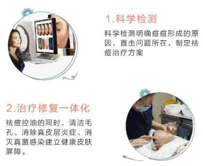 激光去痘印價格多少