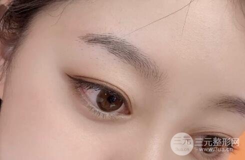 紋眉手術前
