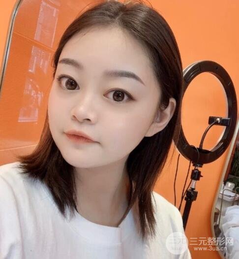 紋眉手術后