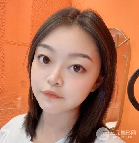 紋眉手術后