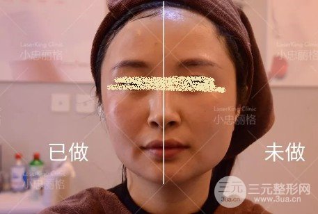 熱瑪吉操作流程