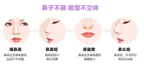 硅膠隆鼻整形手術(shù)