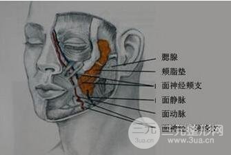 頰脂墊去除墊適合人群