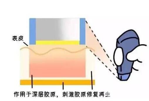 維護(hù)時(shí)間不同
