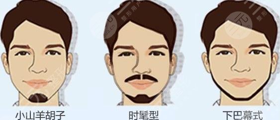 胡須種植適合哪些人群？