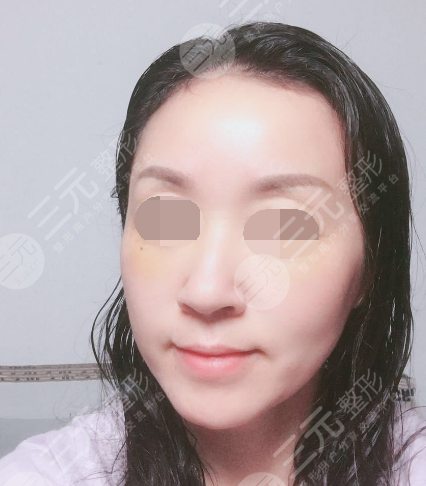 面部年輕化plus全臉，快速解決面部問題，內(nèi)附真實(shí)案例分享圖