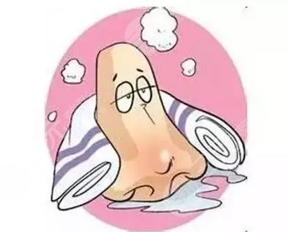 酒糟鼻整形術價格