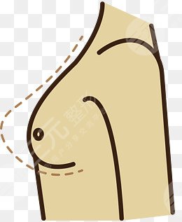 乳房懸吊圖片前后對比圖，術(shù)后一個月果反饋~
