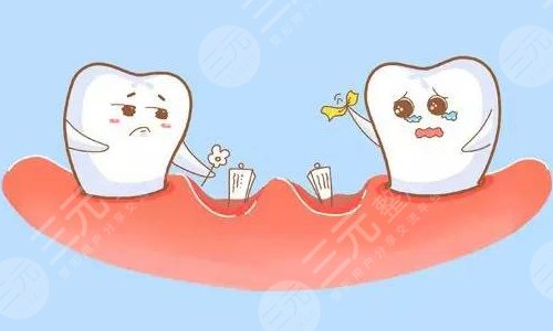 牙齒松動怎么治好的辦法