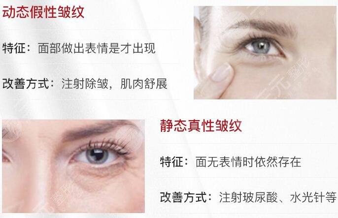 量子微雕美容會不會反彈