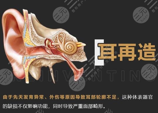 耳再造多少費(fèi)用？?jī)r(jià)格參考&手術(shù)科普，耳整形避雷指南！