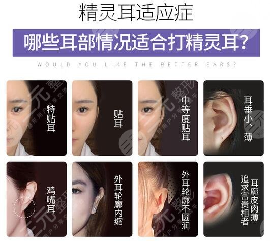 顱耳角在30°-60°之間整形方法