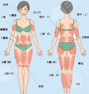 超脂塑溶脂適應部位