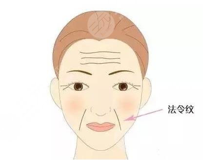 有法令紋怎么辦？去法令紋價(jià)格大概多少錢？附價(jià)格表