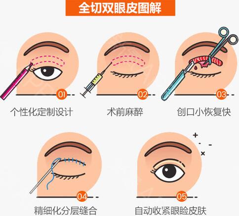 武漢蜜司整形醫(yī)院科普整形知識