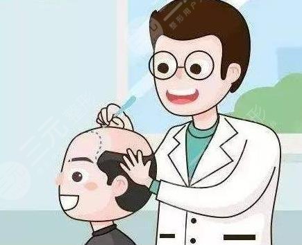 發(fā)際線種植相關(guān)問答科普介紹