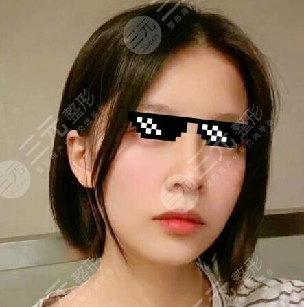 7d聚拉提體驗(yàn)果圖