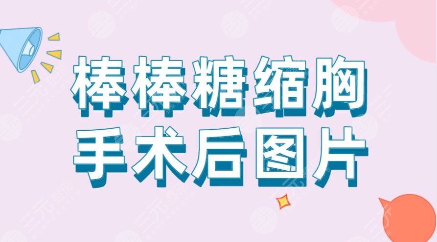 棒棒糖縮胸手術(shù)后圖片！手術(shù)過(guò)程是怎樣的？風(fēng)險(xiǎn)大嗎？附價(jià)格表