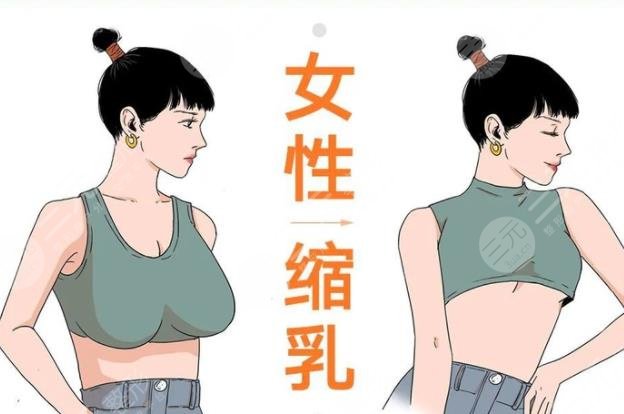 棒棒糖縮胸手術(shù)的恢復(fù)時間