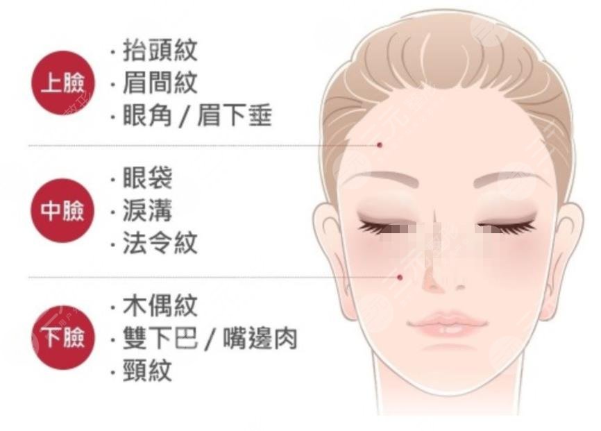 中面部拉皮手術(shù)切口在哪兒?