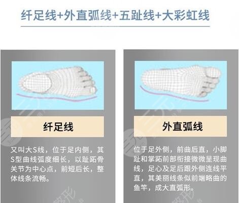 大腳骨外翻怎樣緩解，多少錢？科普講解&術(shù)后注意分享，美足攻略！