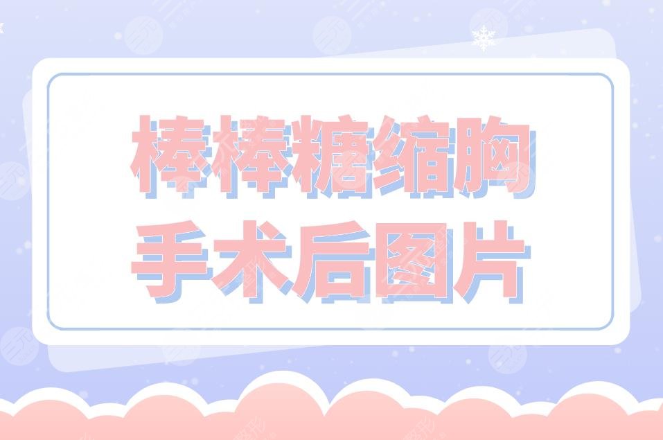 棒棒糖縮胸手術后圖片分享！附手術原理介紹+手術注意事項