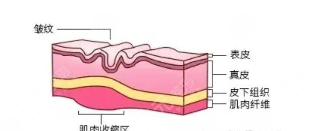 內窺鏡除皺