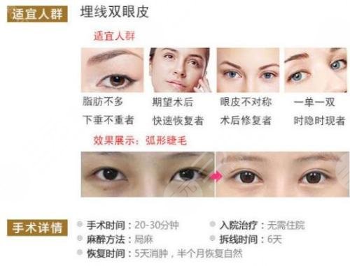 內(nèi)雙怎么變外雙的小竅門(mén)