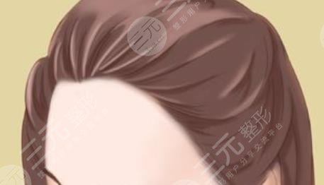 填充額頭