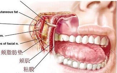 頰脂墊手術(shù)有什么危害嗎?
