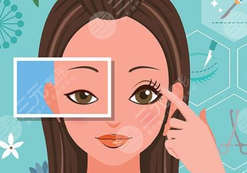 10個(gè)開內(nèi)眼角9個(gè)留疤怎么辦？怎么避免開眼角留疤？注意事項(xiàng)帶你了解！