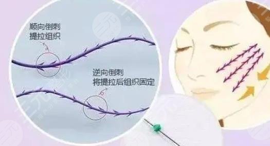 面部抗衰