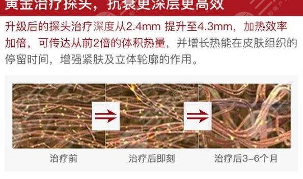 熱瑪吉