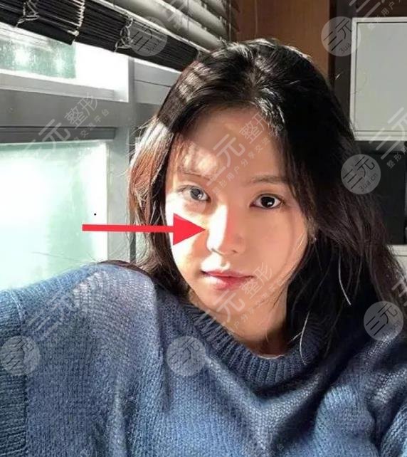 孫娜恩近照鼻子透光被網(wǎng)友熱議整容失??？Apink門面就此隕落！