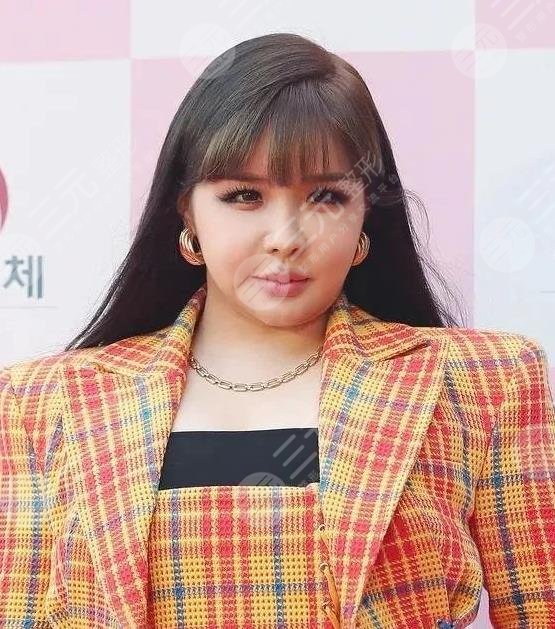 樸春近照被評“整容怪物”！從出道開始整容的她，如今2ne1輝煌不再？