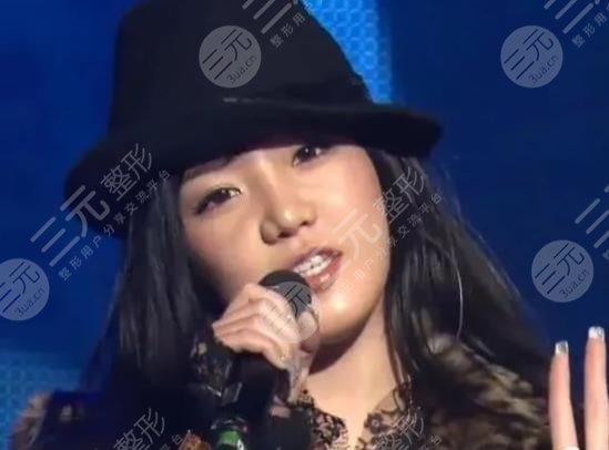 樸春變臉成“怪物”?她動了哪些地方?