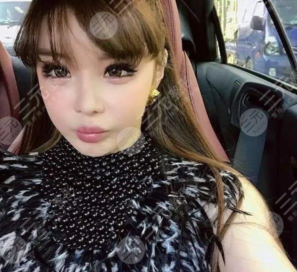 樸春變臉成“怪物”?她動了哪些地方?