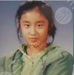 T-ara樸智妍整容過嗎?