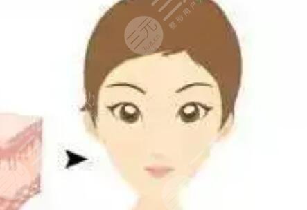 怎么變,v型,小臉,手術(shù),恢復,過程,揭秘