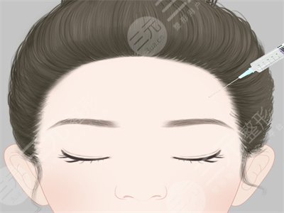 玻尿酸豐太陽穴和自體脂肪填充太陽穴果都不錯(cuò)