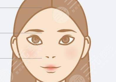 膨體隆鼻排異