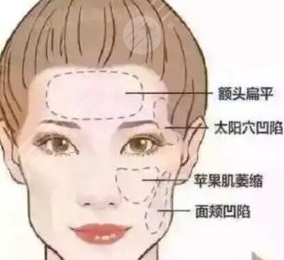 埋埋提升真人整形案例，面部對比果驚艷
