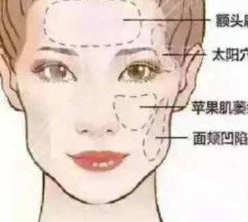 斯美諾整形面b提升怎樣？術后果對比反饋