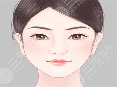 成都艾美薇整形怎么樣？玻尿酸豐蘋果肌果反饋