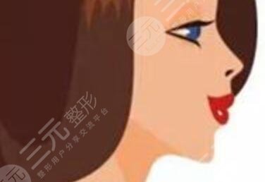 做完假體下巴圖片對(duì)比