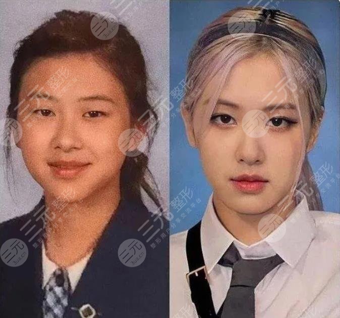 BLACKPINK樸彩英整容實錘了？舊照曝光對比現(xiàn)在大變臉！粉絲卻不認(rèn)？