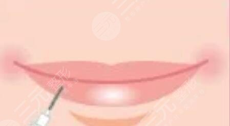 漂唇恢復(fù)七天過程圖，附個(gè)人漂唇經(jīng)歷過程圖片